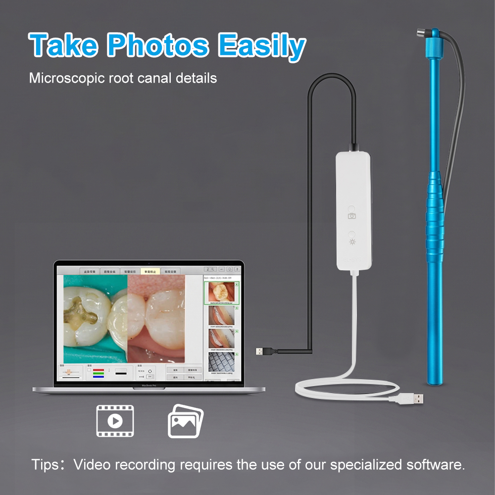 5MP 마이크로 구강 카메라 치과용 구강 내 카메라 H - Mini Pc Windows 리뷰 및 가격